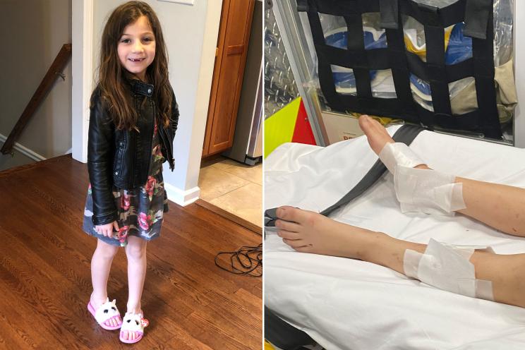 Dylan Dratch, 8, is recovering after a fox attack near her home in Livingston, New Jersey.