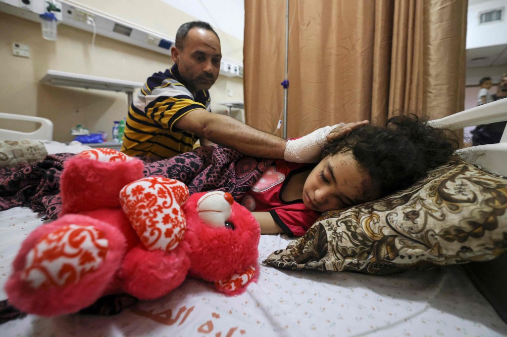 A Palestinian father checks his daughter as they receive medical care at al-Shifa hospital.