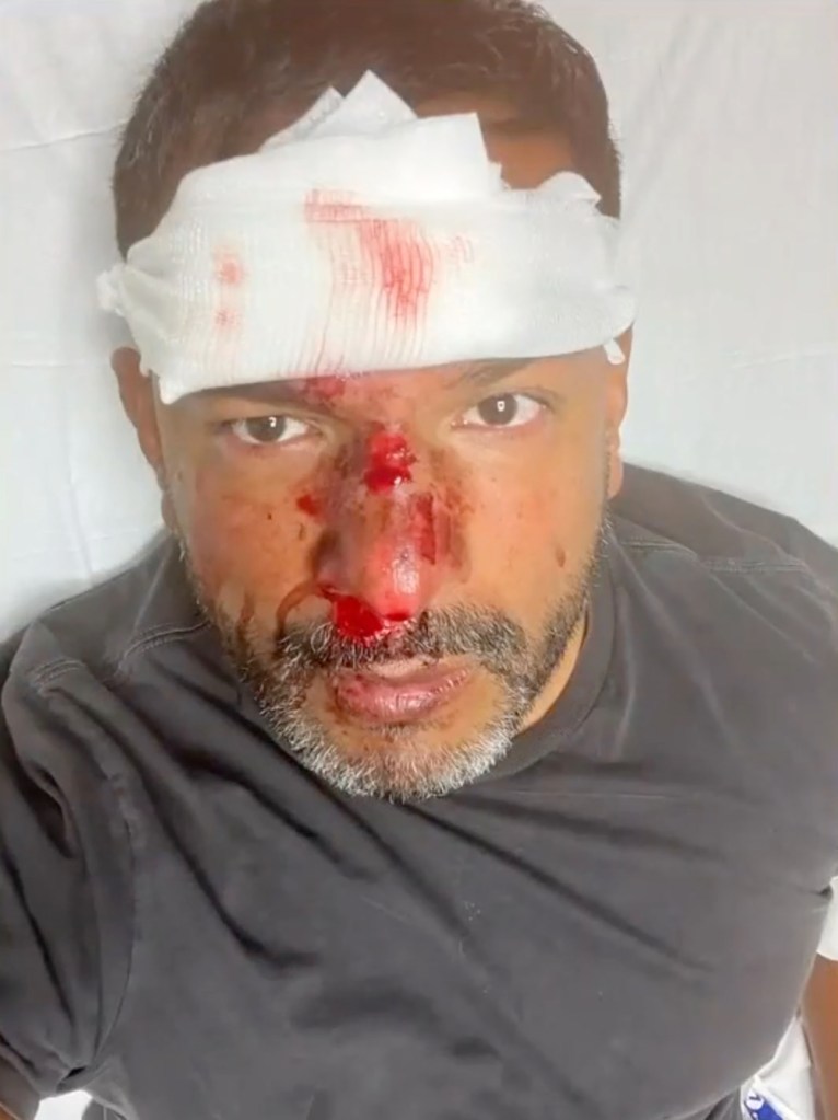 Garcia had to get ten stitches in his face after the attack.