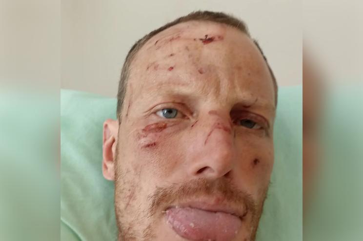 Australian paragliding pro Nick Neynens may never walk again after coming down heavily on to a rock face while gliding in the French Alps.