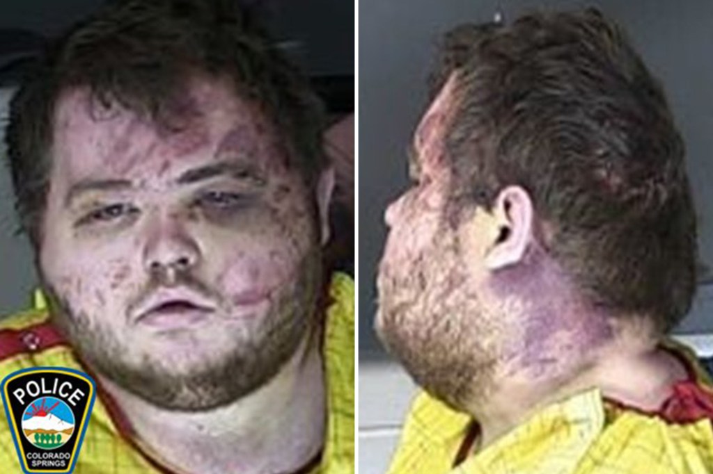 Aldrich appears bruised and battered in his mugshot photo.