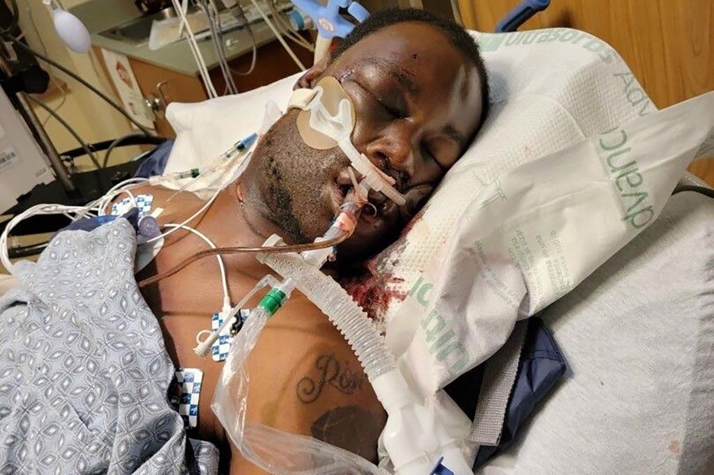 Tyre Nichols is pictured in the hospital before his death.