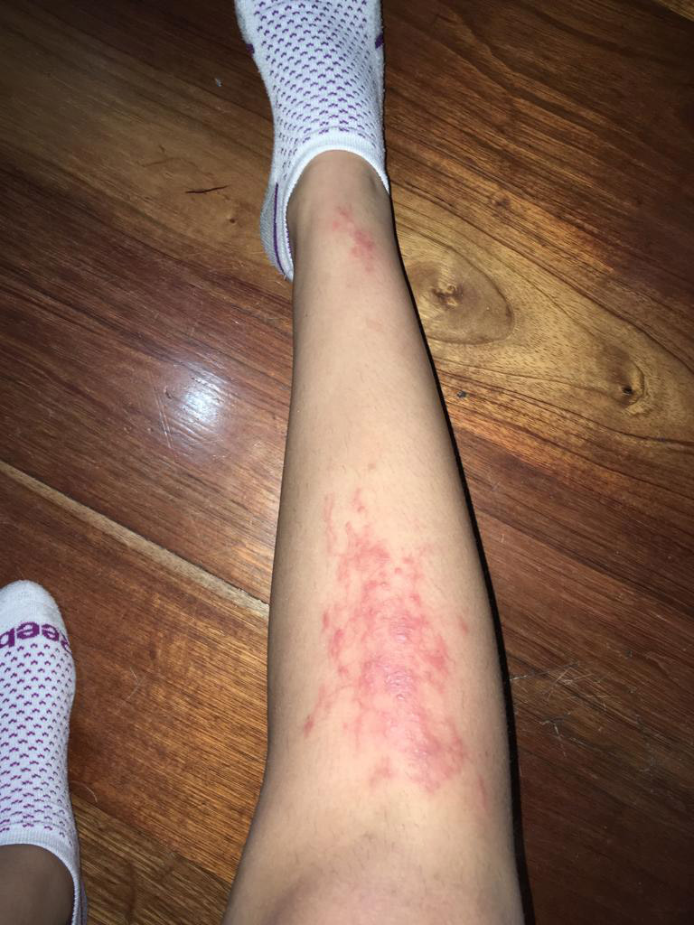 Gomez's leg.