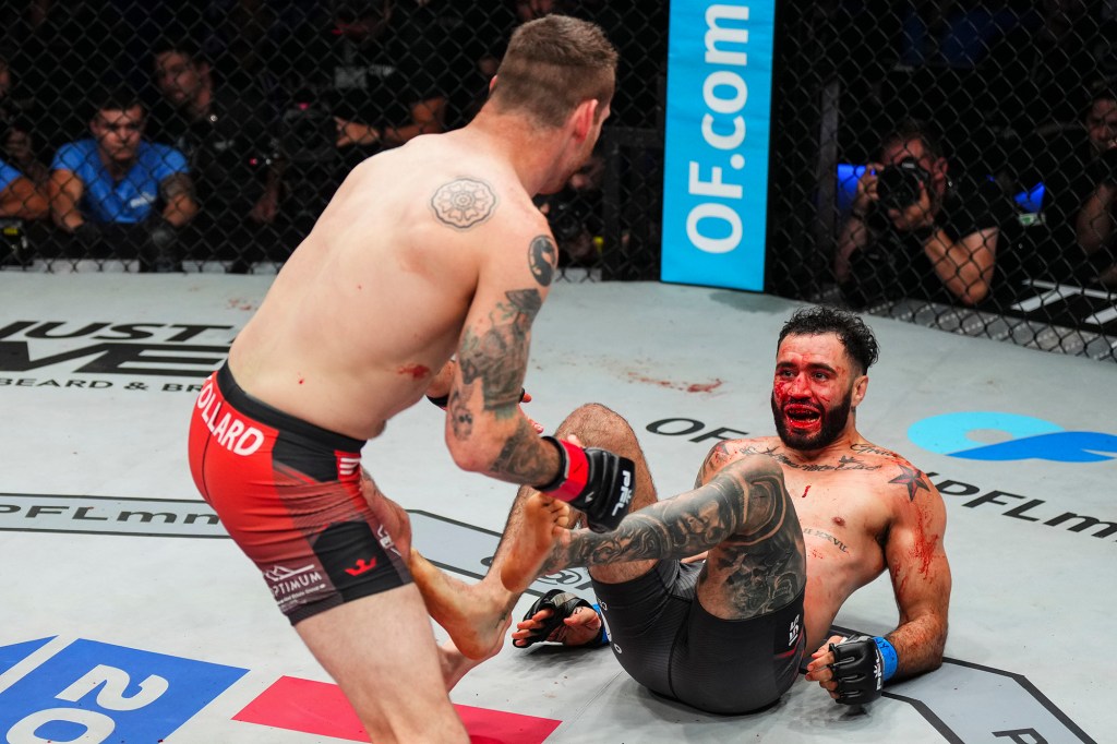 Shane Burgos shows the effects of Clay Collard's hands during his decision defeat on Wednesday night.