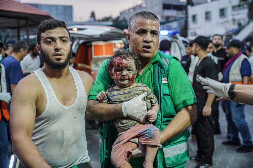 A paramedic holds a little girl with her face full of blood and dirt from the effects of Israeli airstrikes, in Gaza, October 9, 2023.