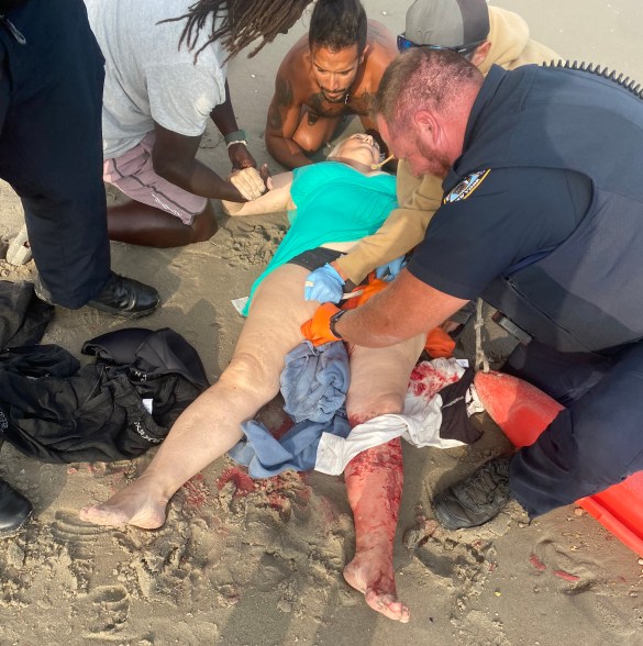 Tatyana Koltunyuk is treated by emergency personnel after she was bitten by a shark on Rockaway Beach, NY, Monday, Aug. 7, 2023.