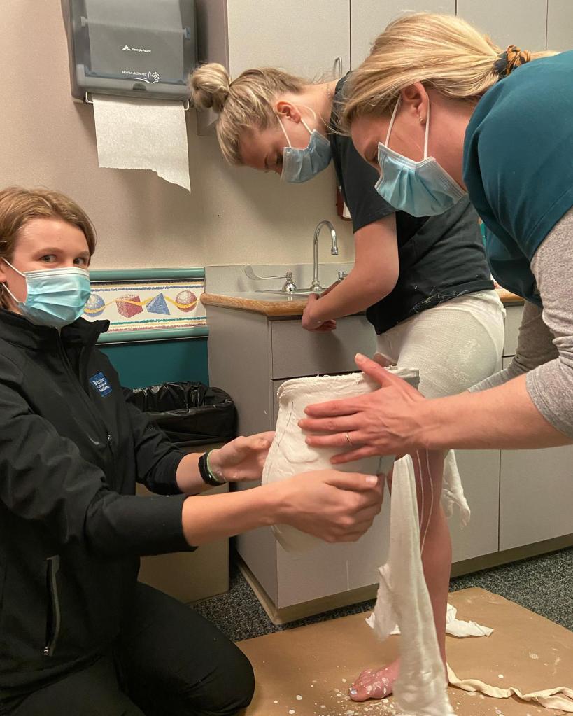 The extent of her leg injury forced doctors to amputate her leg, not once but five times.