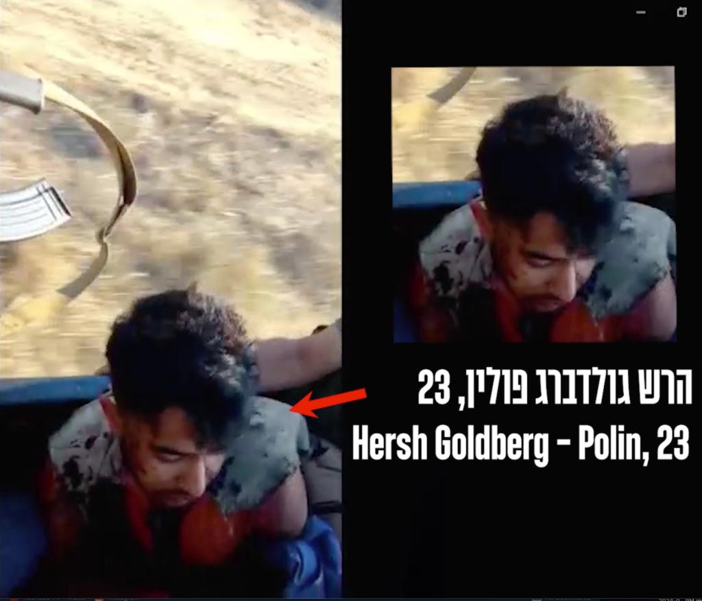 Israeli American Hersh Goldberg-Polin is seen in a new Hamas video covering in blood, with his bone protruding from a makeshift tourniquet.