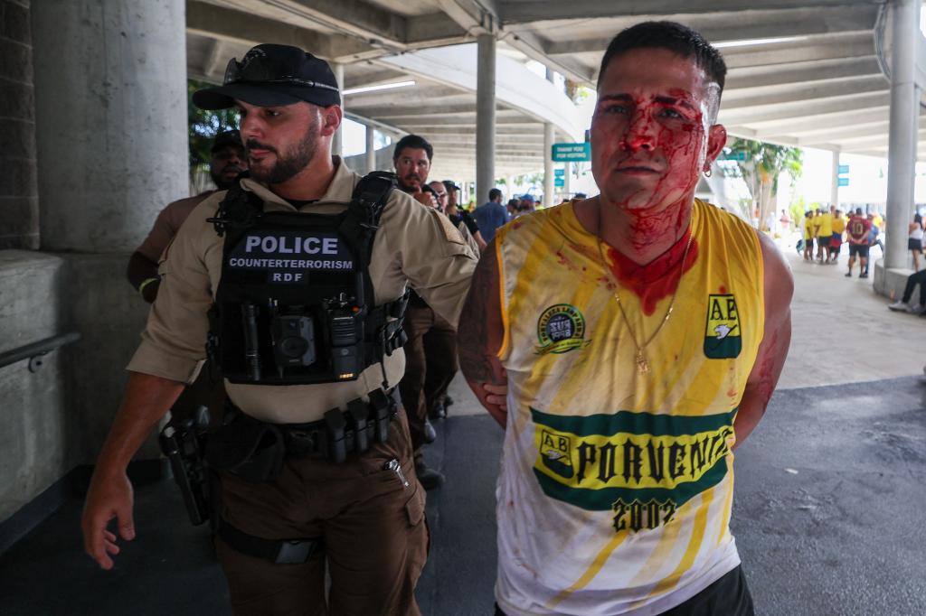 A bloody fan is detained by police before the Copa America final on Sunday.