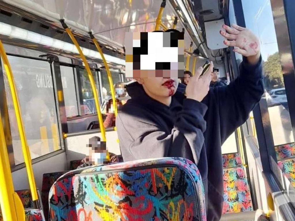 teen attacked on bus 