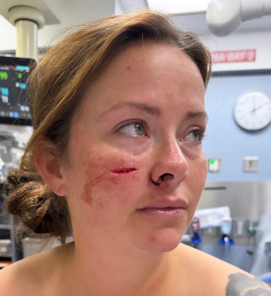 Melissa Mauldin was stabbed in the face on Sunday.