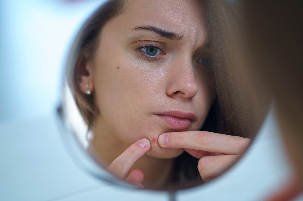 A woman trying to pop a zit. 