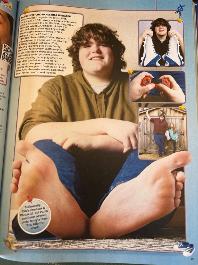 Eric Kilburn, Jr. is featured in the 2025 Guinness World Records book as the teenager with the world's largest feet and hands.
