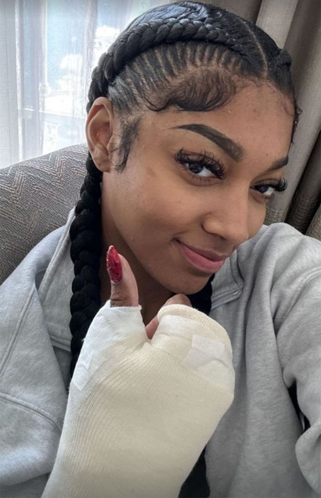 Sky rookie Angel Reese posts a photo of her cast after season-ending surgery to repair a fractured left wrist on Sept. 10, 2024. 