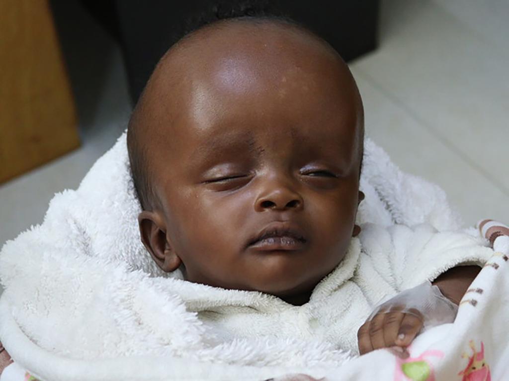 An Kenyan infant named Ryan was immediately given financial support for an operation by other people named Ryan.