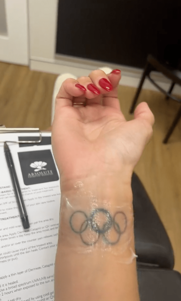 Brianna Throssell sharing her tattoo removal story as a cautionary tale