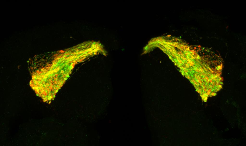 University of Southampton researchers gave the drug to fruit flies that had toxic tau. Here is the brain of a 7-day-old fruit fly with tau. The green outlines the neurons, which are starting to swell and degenerate due to the tau. The red shows where tau is building up.