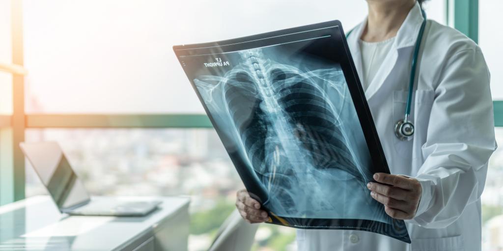 Doctor examining a chest x-ray film for diagnosis of asthma, lung disease, COVID-19, or bone cancer