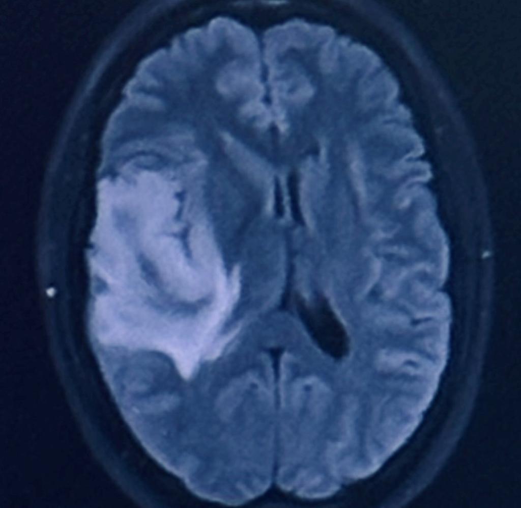 Close-up image of a brain