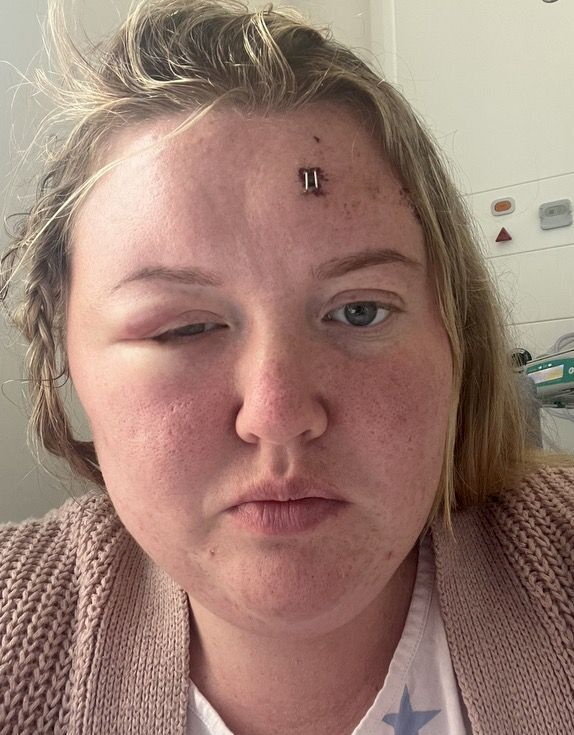 A woman with a piercing on her forehead