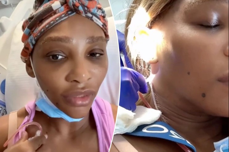 Serena Williams shares she had grapefruit-sized cyst remove from neck