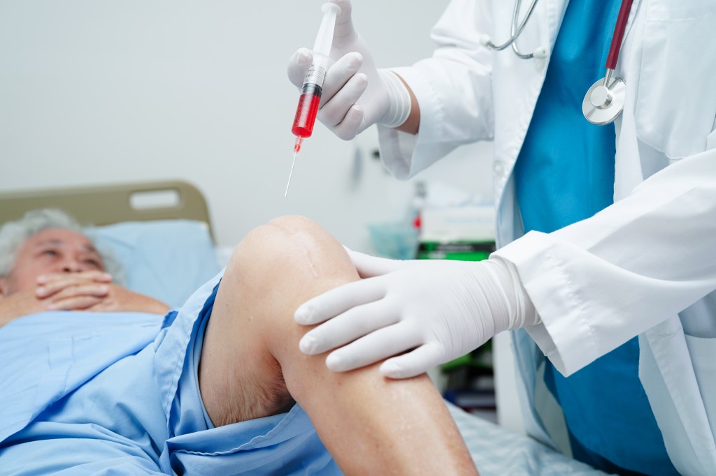 Osteoarthritis is characterized by joint pain that worsens over time.
