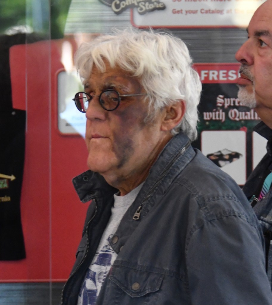 The left side of Leno's body was badly bruised.