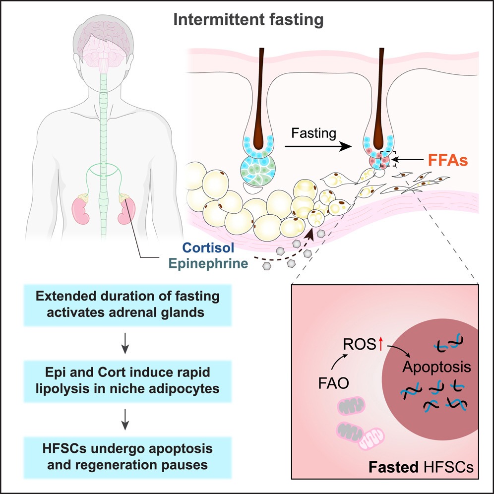 Intermittent fasting forces the body to use stored fat as its primary energy source instead of readily available sugar from food. This process can lead to the death of hair follicle stem cells. Here, a graphic from the study shows the effect of fasting on hair follicle stem cells.