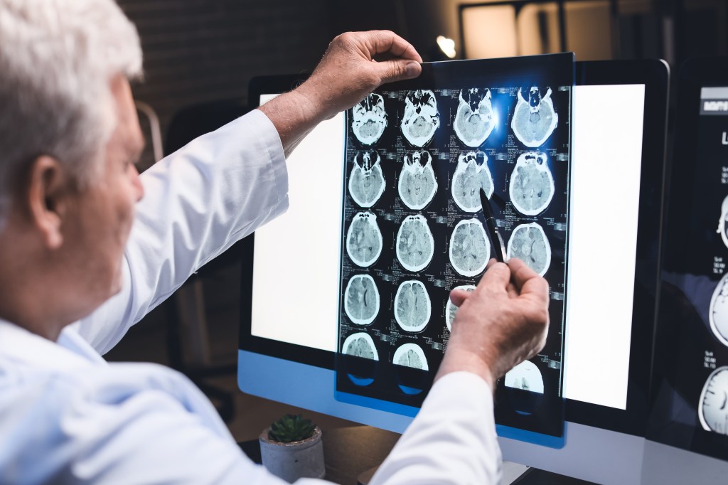 A senior neurologist examining an MRI scan of a human head in a clinic