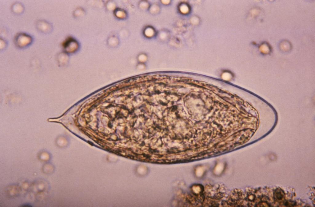 Photomicrograph of an egg from the S. haematobium parasite. 
