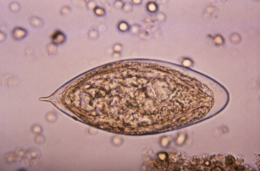 Photomicrograph of an egg from the S. haematobium parasite. 