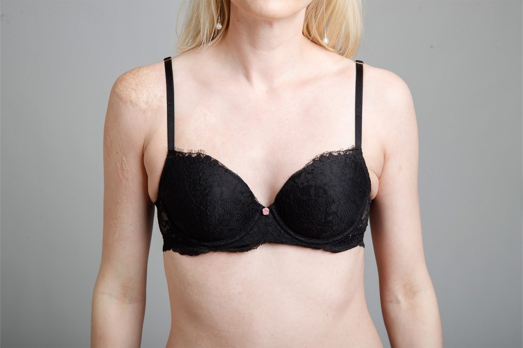 Woman in bra.