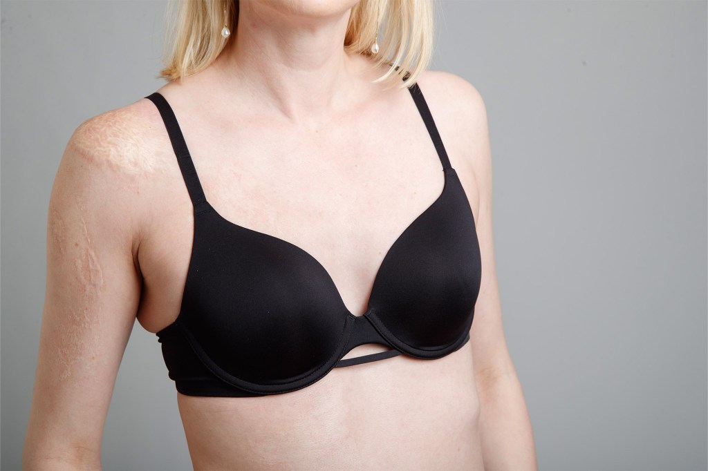 Woman in bra