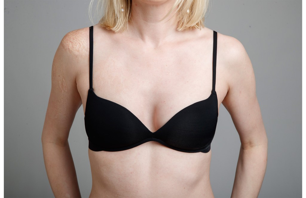 Woman in bra