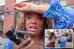 Pro-life activist left covered in blood after being sucker-punched during NYC street interview on abortion