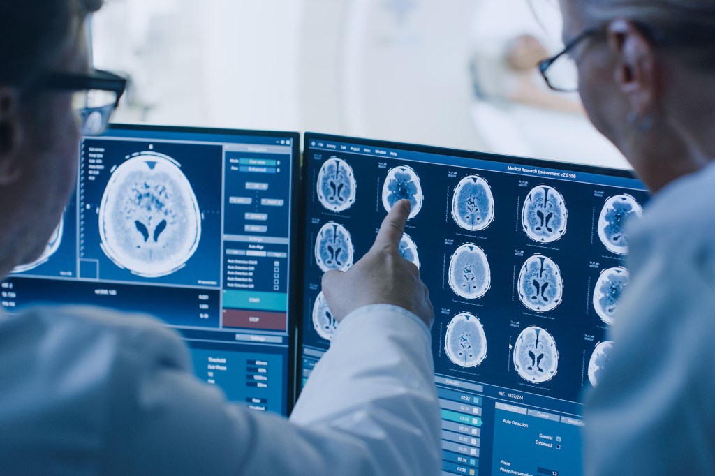 cancer caused by ct scans