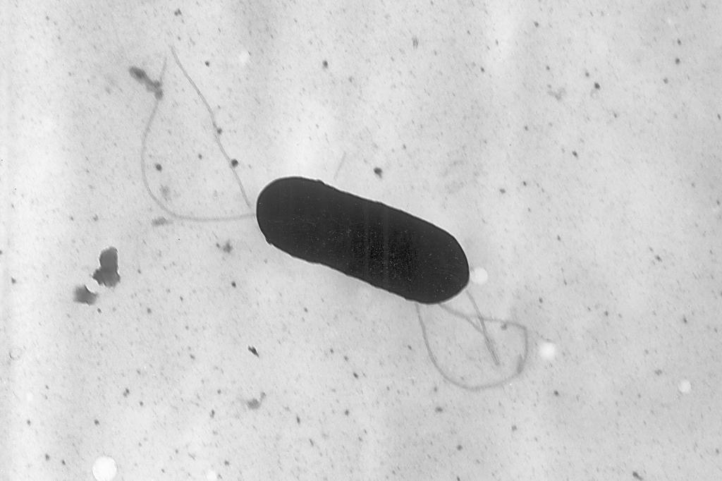microscope image made available by the Centers for Disease Control and Prevention shows a Listeria monocytogenes bacterium.
