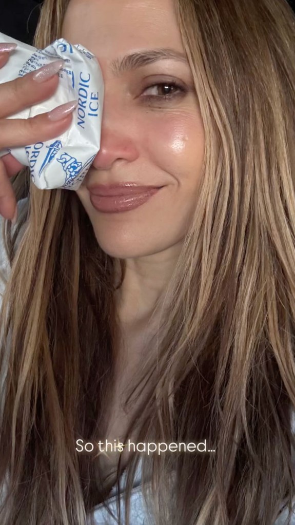 Jennifer Lopez cut her face rehearsing for the 2025 AMAs. Here, Lopez with an ice pack on her eye