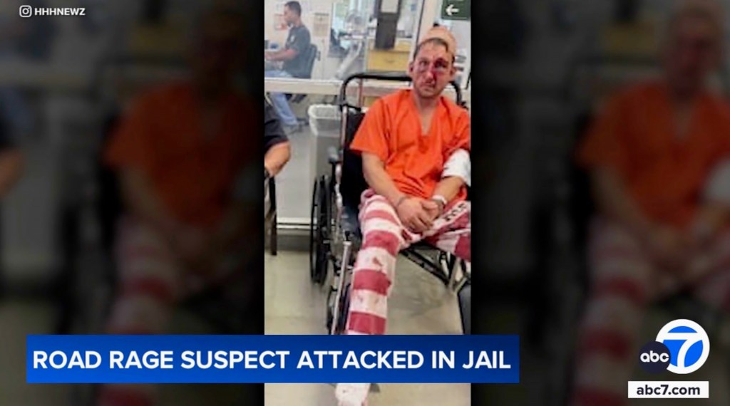 Nathaniel Radimak is seen in a wheel chair after he was beaten by other inmates in a Hawaii prison facility.