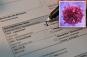 Doctors near HIV cure with 'previously impossible' discovery: 'We have never seen anything close to as good'