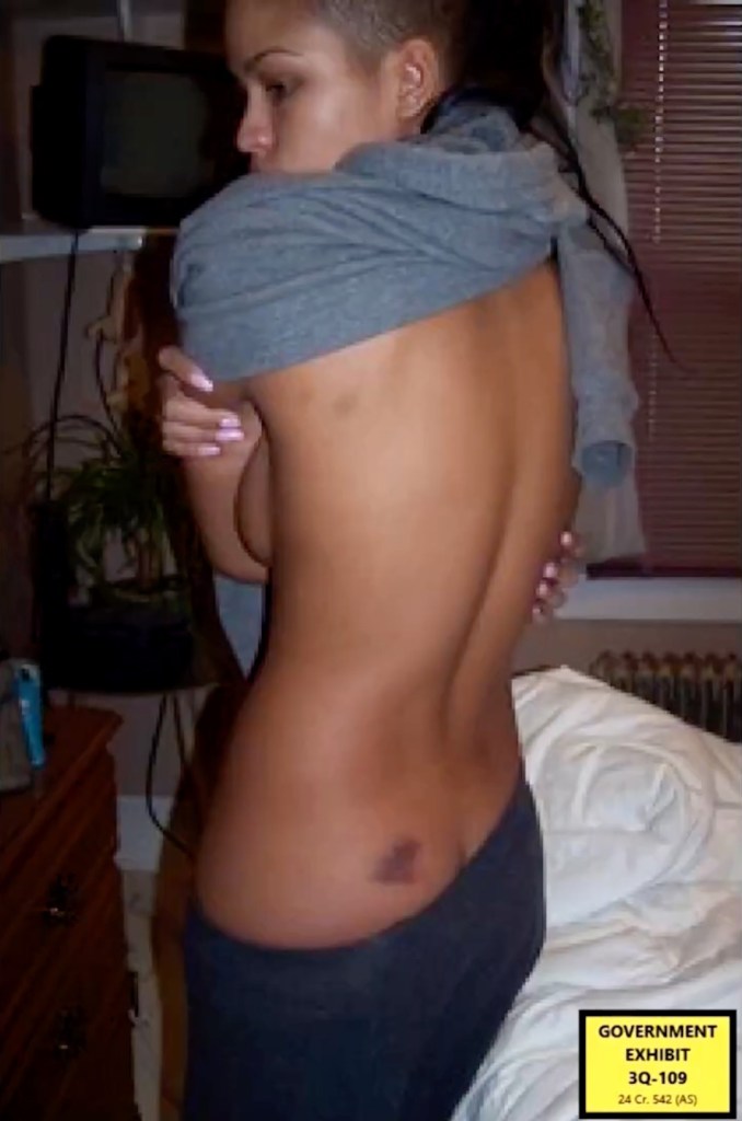 Government Exhibit 3Q-109 showing a woman's back with a bruise.